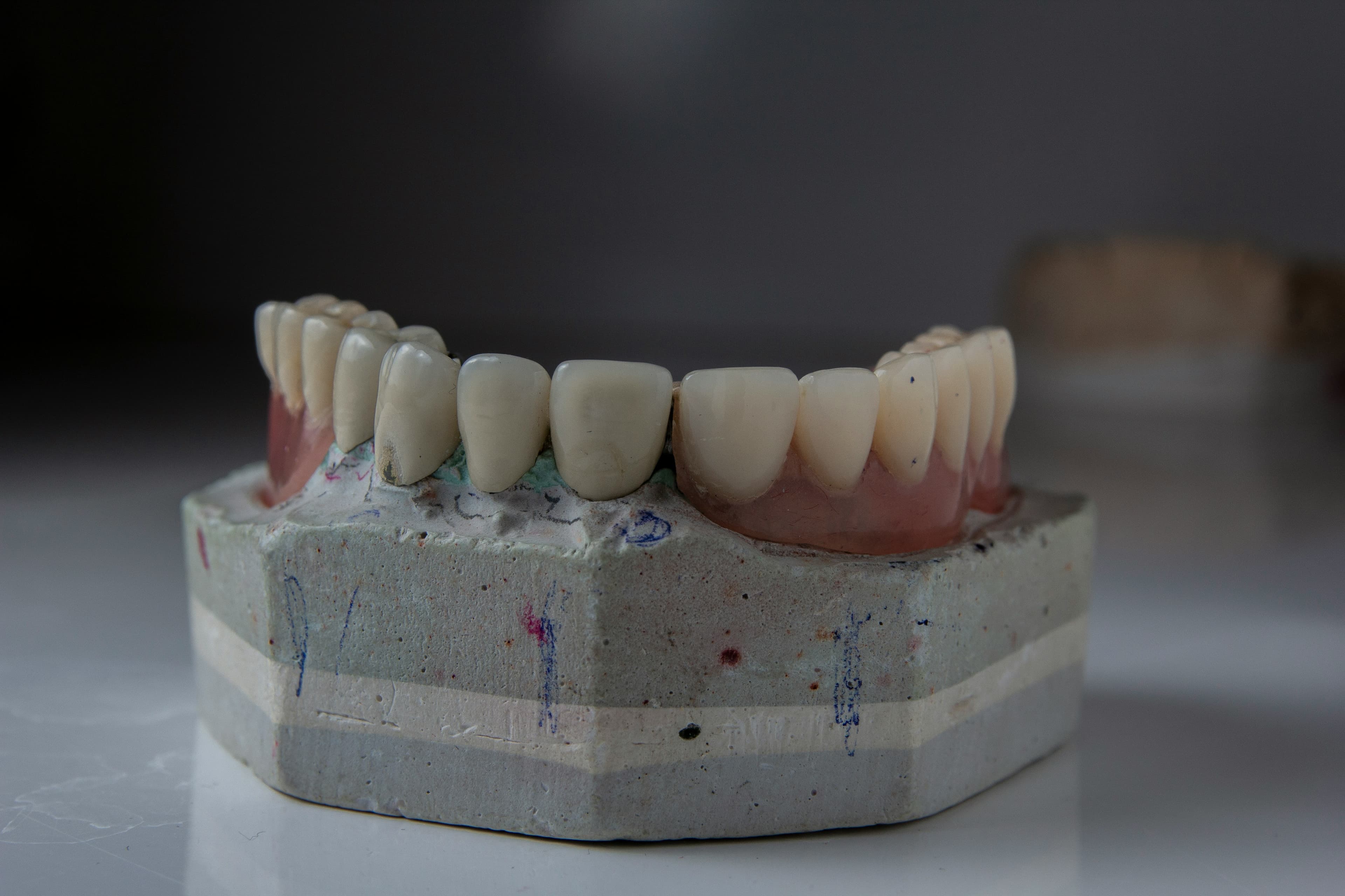 Moderne CAD/CAM-Fräse im Einsatz